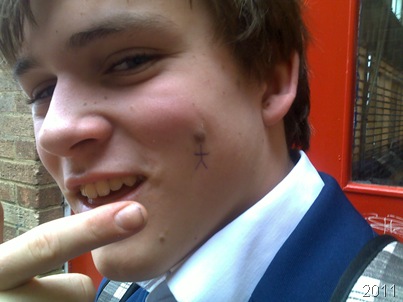 This stick-man was drawn on my face, using my mole as a head, making for a rather funny picture. 